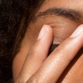 Can Stress Cause Eczema on the Eyelids? - An Expert's Perspective