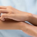 Eczema Creams: What's Safe During Pregnancy?