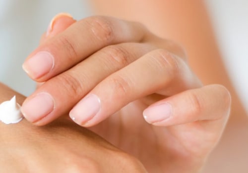 Treating Eczema: A Comprehensive Guide