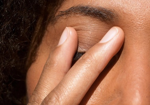 Understanding Eyelid Eczema: Causes, Symptoms, and Treatment