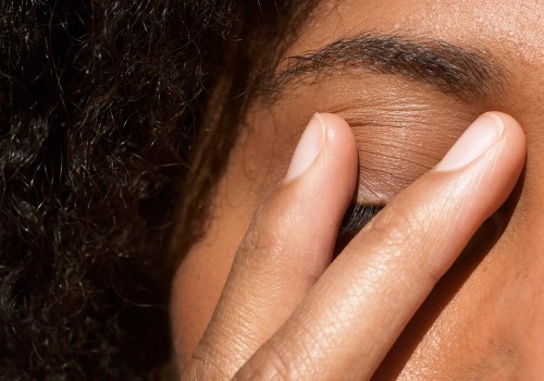 Can Stress Cause Eczema on the Eyelids? - An Expert's Perspective