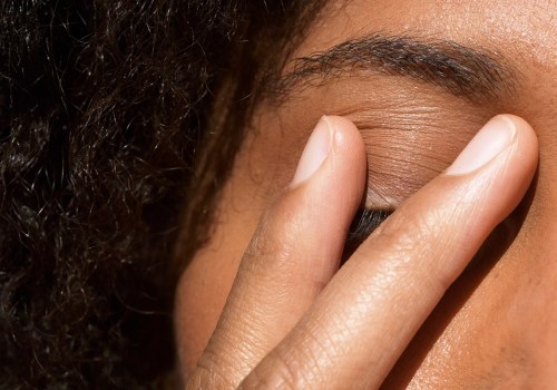 Can Stress Cause Eczema on the Eyelids? - An Expert's Perspective