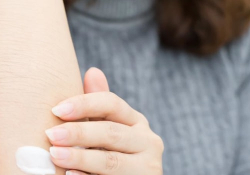 The Best Creams for Eczema and Dermatitis: Expert Advice