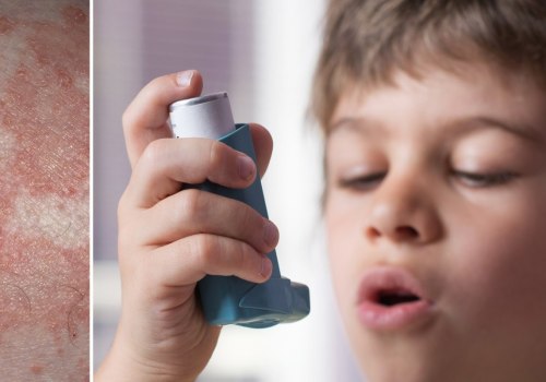 The Link Between Eczema and Asthma: Are They Related?